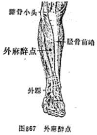 外麻点-体表示意图