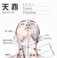 天鼎-断层解剖图 天鼎-解剖图