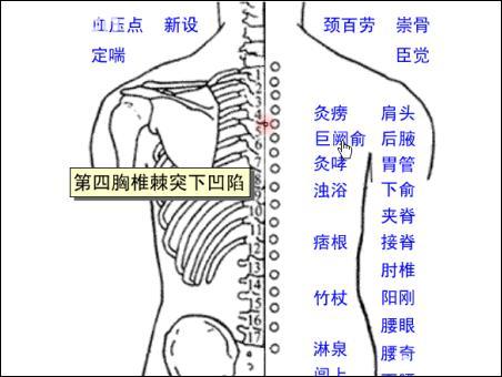 巨阙俞-体表示意图