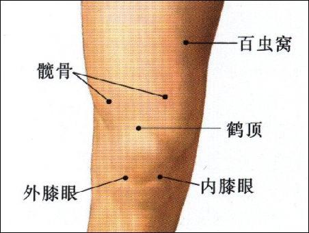 百虫窝-体表示意图