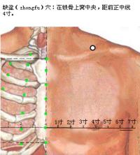 缺盆-体表示意图