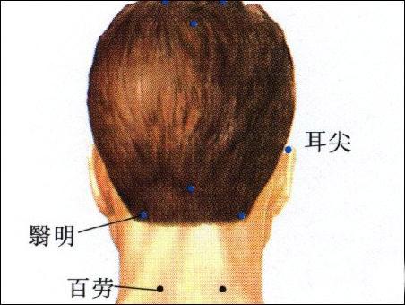 耳尖-体表示意图