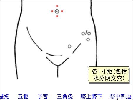 脐中四边-体表示意图